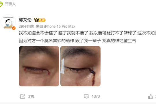 郭艾伦：我以后可能打不了篮球了，疑似眼睛被打瞎