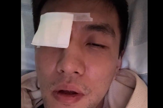 郭艾伦眼伤细节公布，被队员用手指直接扎进了眼珠里缝了40多针