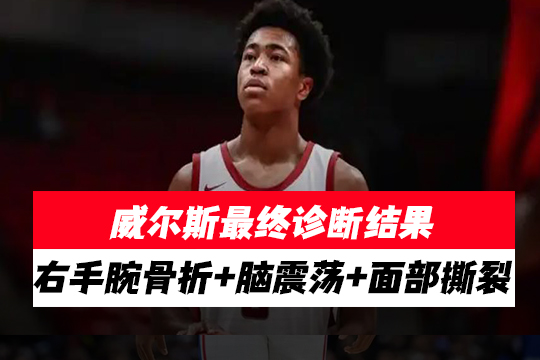 威尔斯最终诊断结果：右手腕骨折+脑震荡+面部撕裂